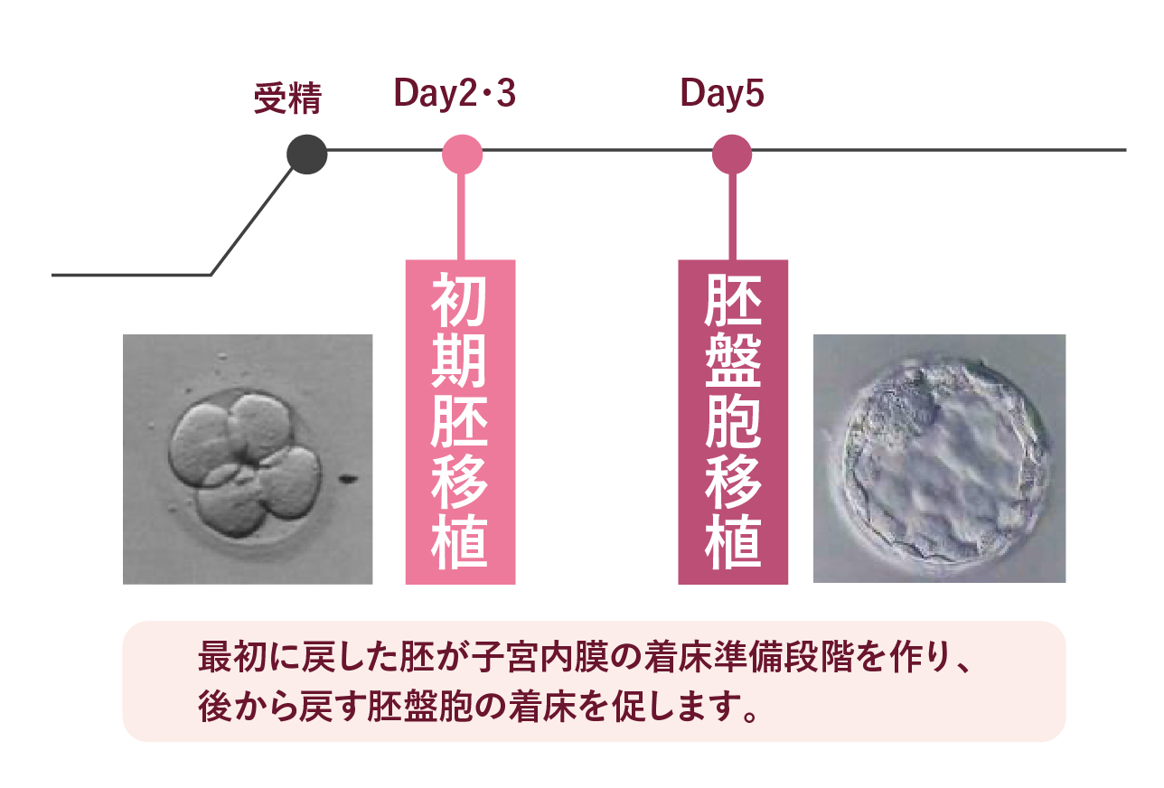 二段階胚移植