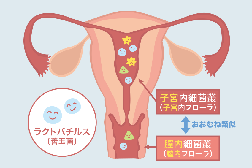 子宮内フローラ検査