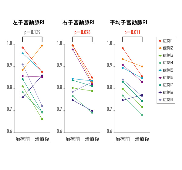 骨盤内の血流が良くなる