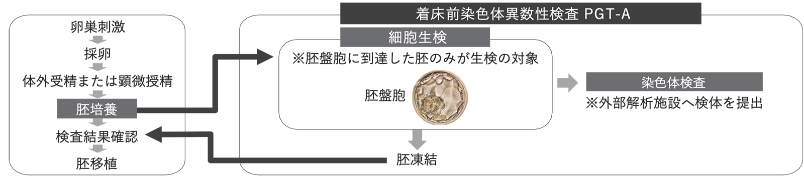 検査の流れ