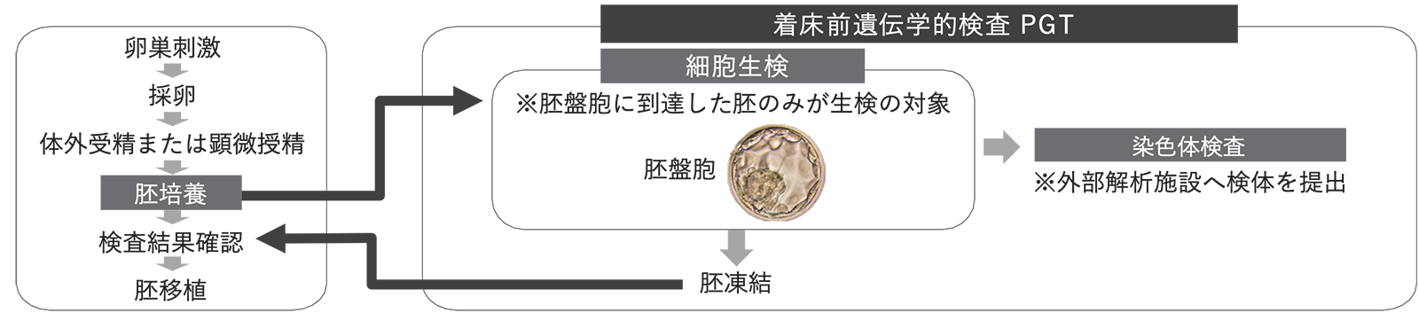 検査の流れ