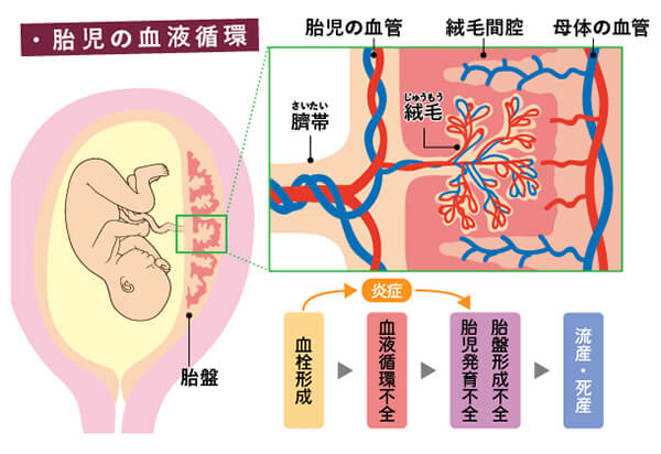 不育症の原因 胎児の血液循環