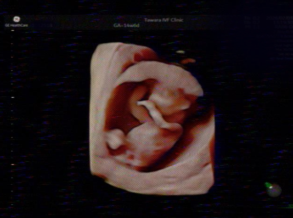 GE�w���X�P�A�E�W���p��������А�VolusonSignature18