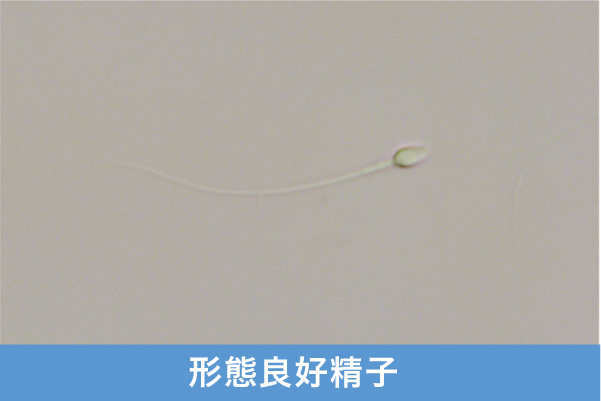 良好精子