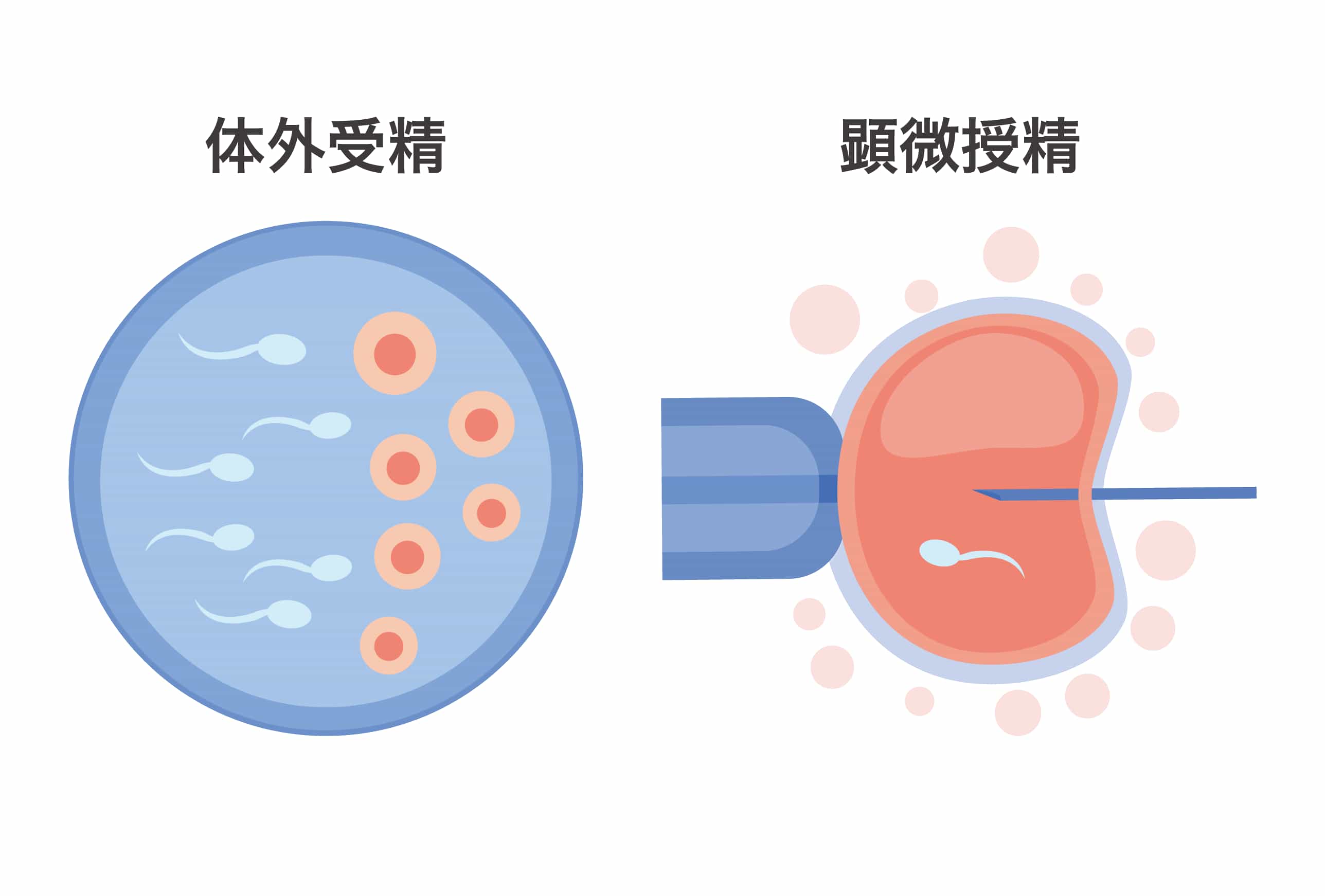 受精